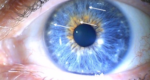 Iridology